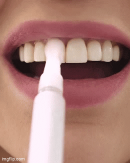 Stylo de blanchiment des dents PAP SMILE NOW