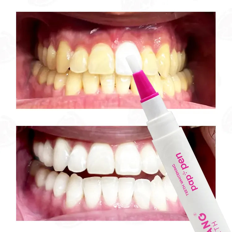 Stylo de blanchiment des dents PAP SMILE NOW